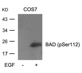 Anti-Phospho-Bad (Ser112)