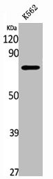 Anti-SIRT1