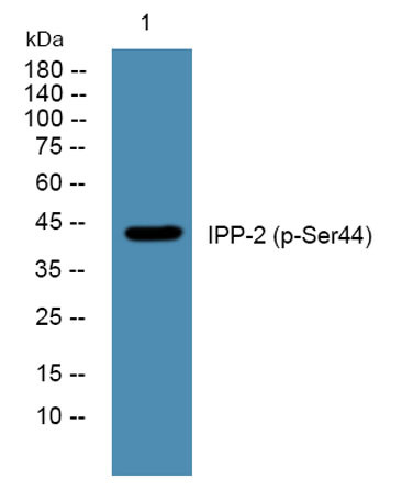 Anti-phospho-IPP-2 (Ser44)