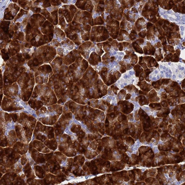 Anti-AQP12A