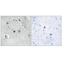 Anti-COL11A2