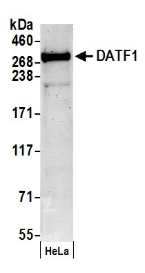 Anti-DATF1