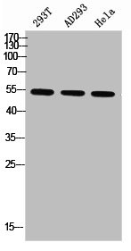 Anti-Phospho-PARK2 (S131)