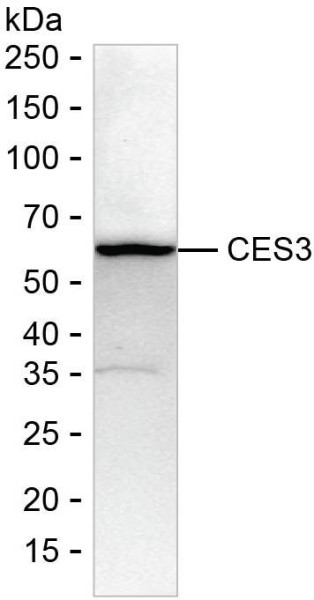 Anti-CES3