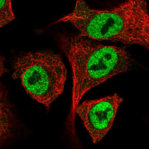 Anti-IRF2BP1