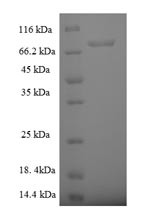 Rab5 GDP/GTP exchange factor (RABGEF1), human, recombinant