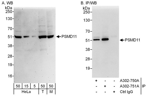 Anti-PSMD11