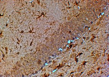 Anti-TRPM7