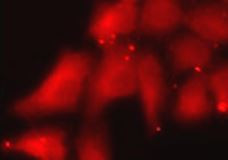 Anti-Islet-1