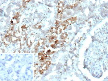 Anti-PVALB / Parvalbumin, clone PVALB/12610R