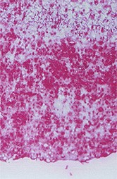 Anti-Hexanoyl-Lys [HEL], clone 5F12
