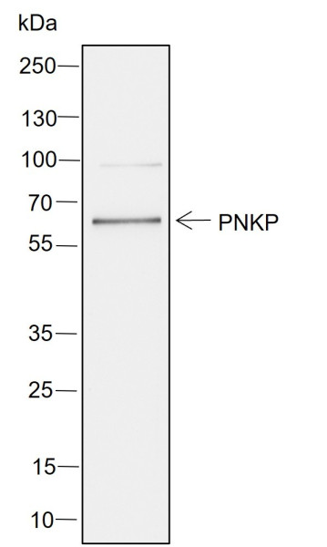 Anti-Recombinant PNKP, clone A752
