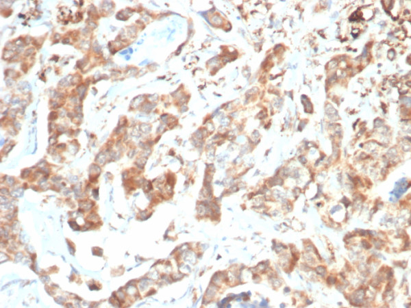 Anti-CD269 / TNFRSF17 / BCMA (B-Cell Maturation Protein), clone BCMA/7254