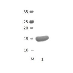 TX1B3 PDZ Domain