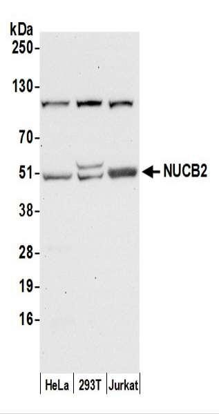 Anti-NUCB2