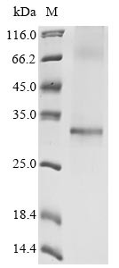 Apolipoprotein L domain-containing protein 1 (APOLD1), human, recombinant