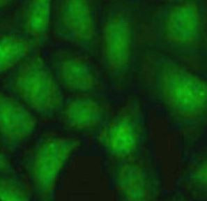 Anti-PSME1