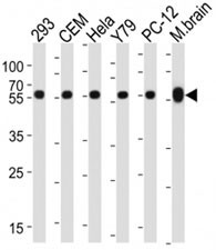 Anti-Beta-Tubulin (TUBB), clone 87CT59.3.7
