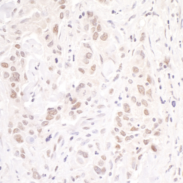 Anti-p66beta/GATAD2B