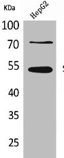 Anti-SPTLC1