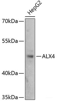 Anti-ALX4