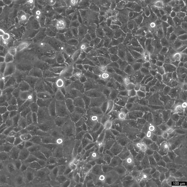HuCC-T1 Cells