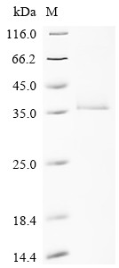 Ras-related protein Rab-33A (RAB33A), human, recombinant