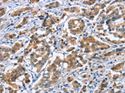 Anti-CRABP2
