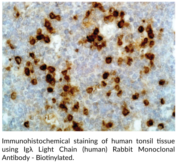 Anti-Iglambda Light Chain (human) Rabbit Monoclonal Antibody - Biotinylated (RM127)