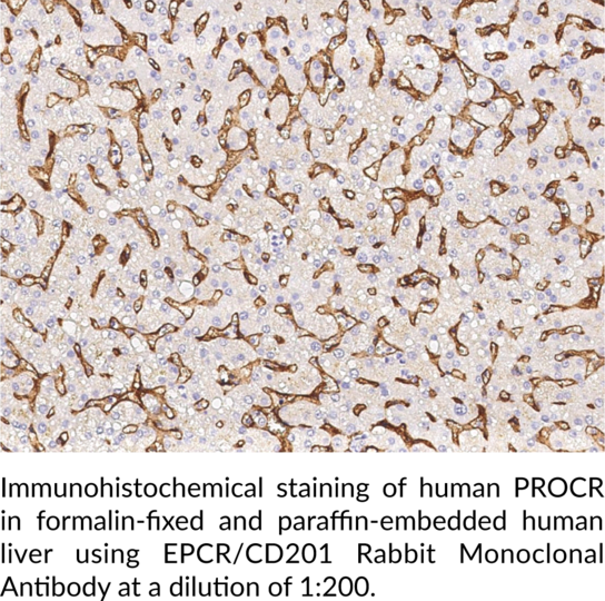 Anti-EPCR/CD201 Rabbit Monoclonal Antibody (Clone 041)