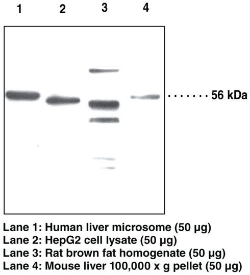 Anti-Adipose Triglyceride Lipase