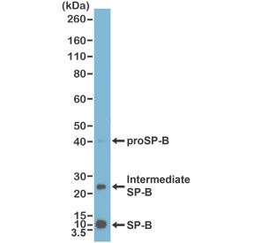 Anti-SP-B / Surfactant protein B, clone RM370