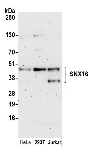 Anti-SNX16