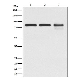 Anti-Gamma Catenin / Plakoglobin, clone AOBD-10