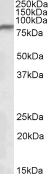Anti-NDUFS1, Internal