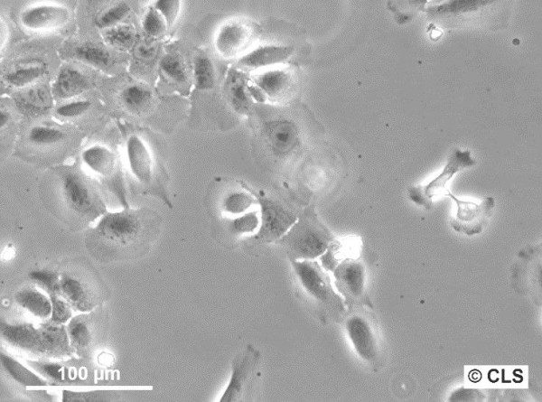 PDV Cells