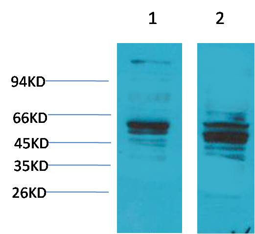 Anti-Bombesin Receptor 2