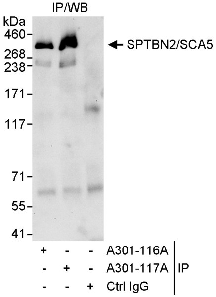Anti-SPTBN2/SCA5
