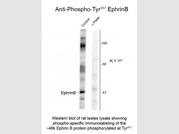 Anti-phospho-EphrinB (Thr317)