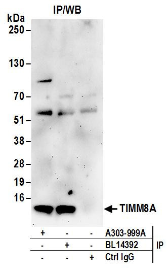 Anti-TIMM8A