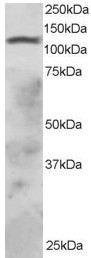 Anti-RNF31 / ZIBRA, C-terminal