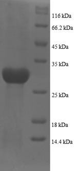 Plexin-A1 (PLXNA1), partial, human, recombinant
