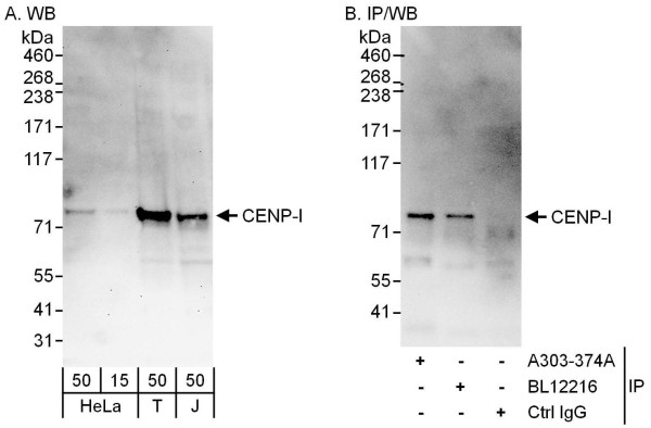 Anti-CENP-I