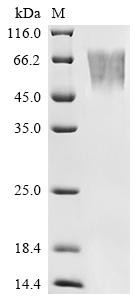 Fractalkine (CX3CL1), partial, Biotinylated, human, recombinant