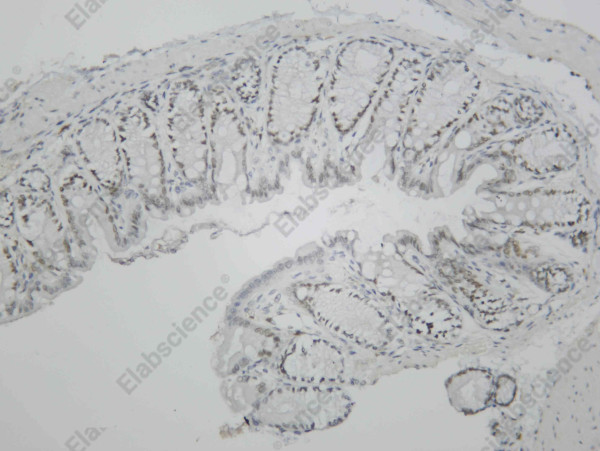 Anti-Recombinant ERR1, clone C112401