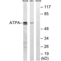 Anti-ATP5A1