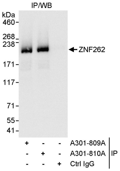 Anti-ZNF262