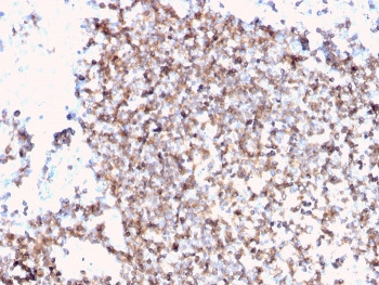 Anti-CD45 (Leukocyte marker), clone PTPRC/3881R