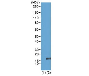 Anti-H3K36me3 / Trimethyl Histone H3 Lysine 36, clone RM155 (recombinant antibody)