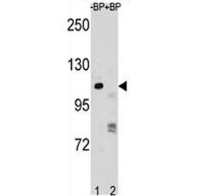 Anti-PARP1